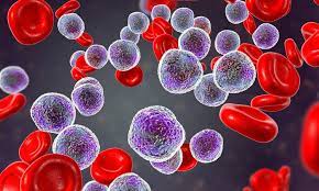 Leukemia Therapeutics Treatment Industry