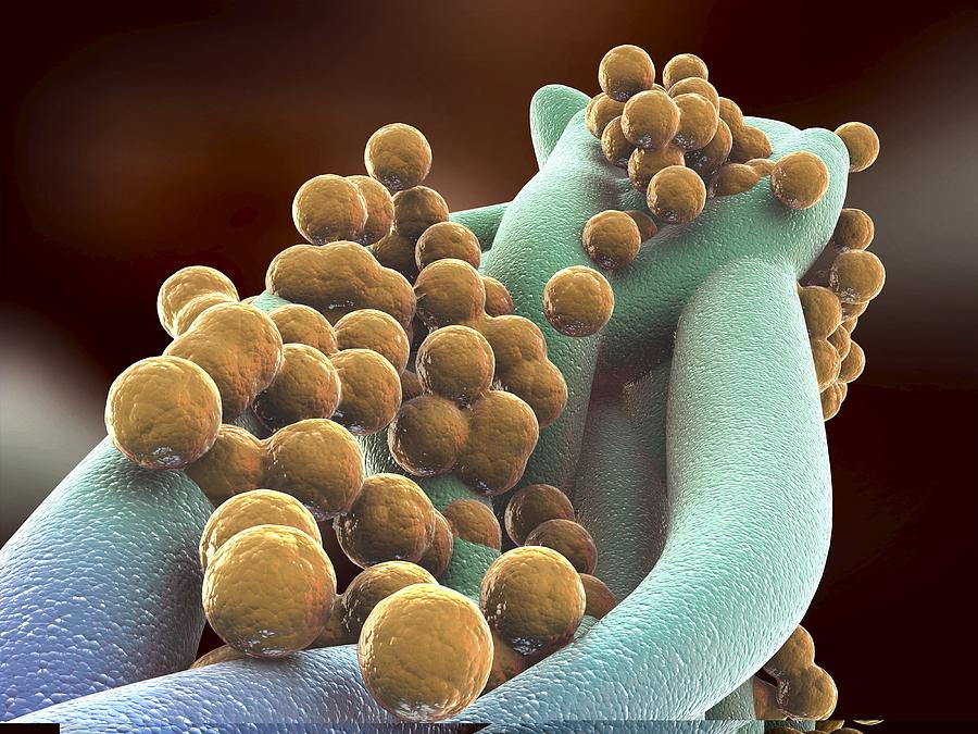 Methicillin-Resistant Staphylococcus aureus (MRSA)