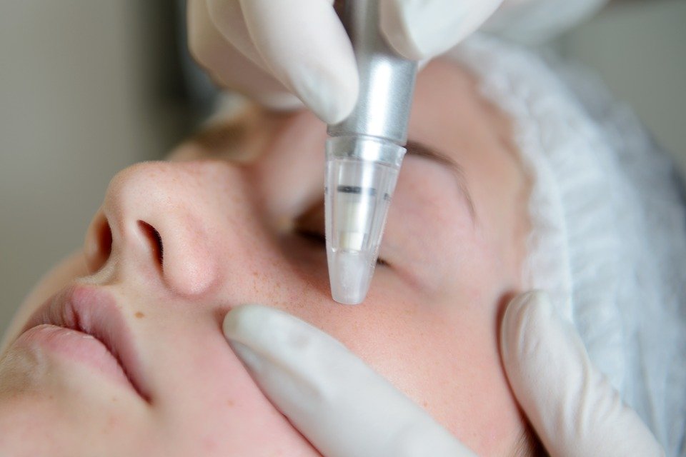Microdermabrasion Devices market