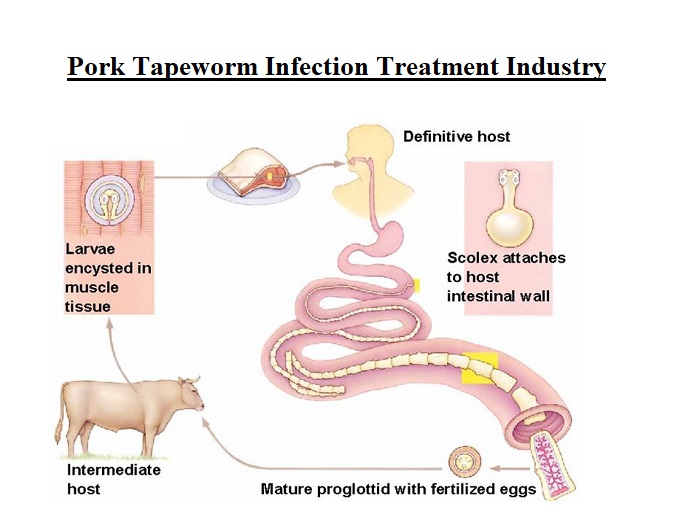 Pork Tapeworm Infection Treatment Industry