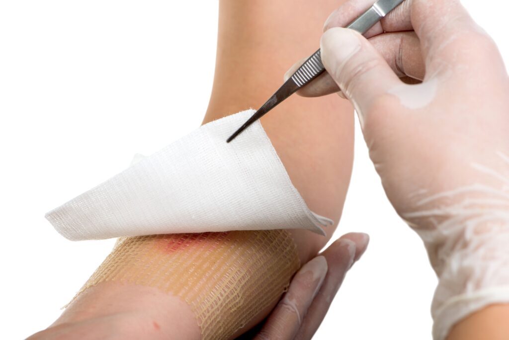 Antimicrobial Wound Care Dressings Industry