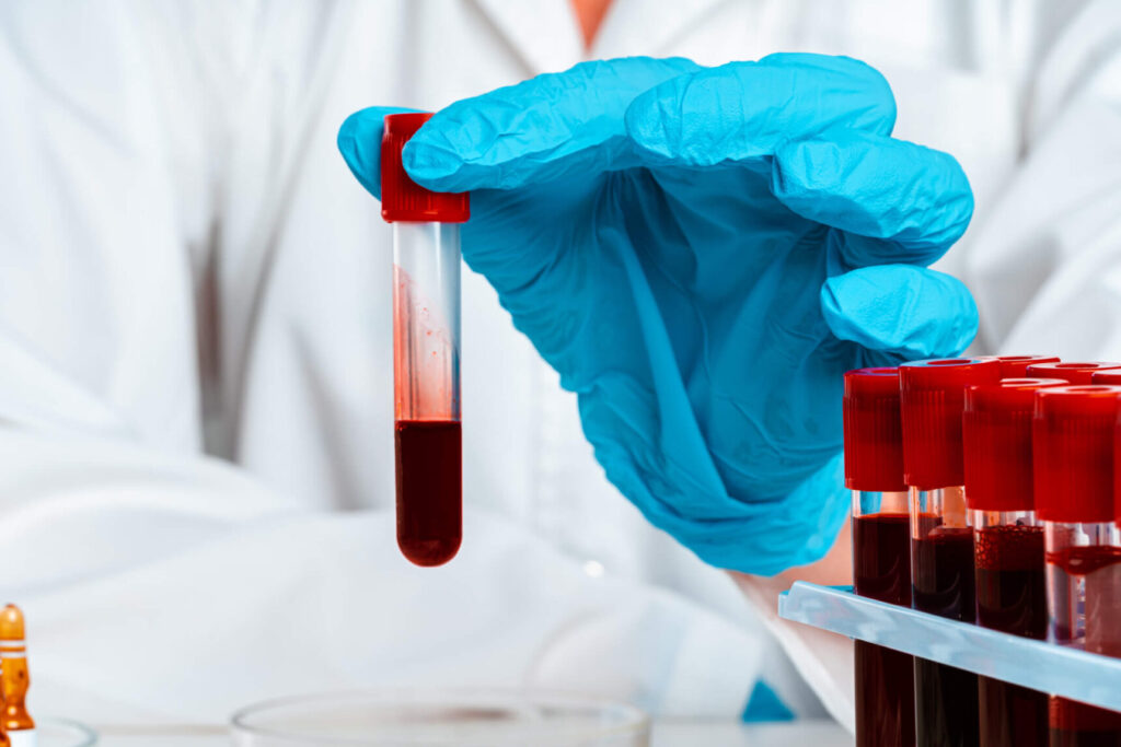 Blood Coagulation Analyzers Industry