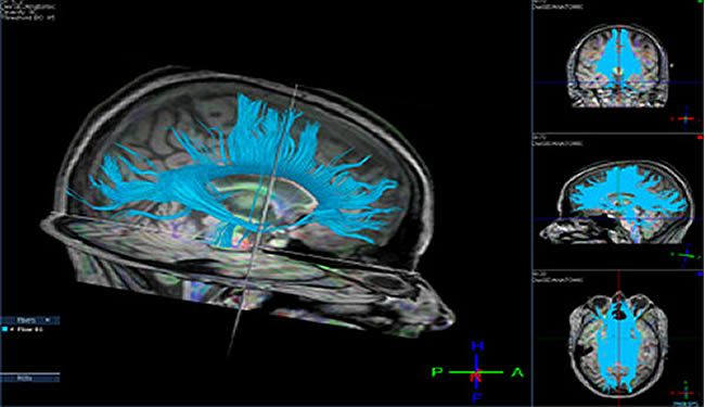 Brain Imaging and Neuroimaging Industry