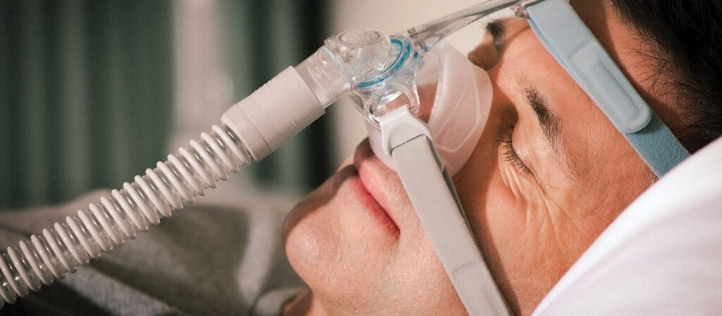 Continuous Positive Airway Pressure (CPAP) Industry