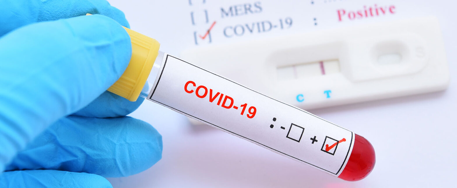 Global Covid-19 Diagnostics Industry