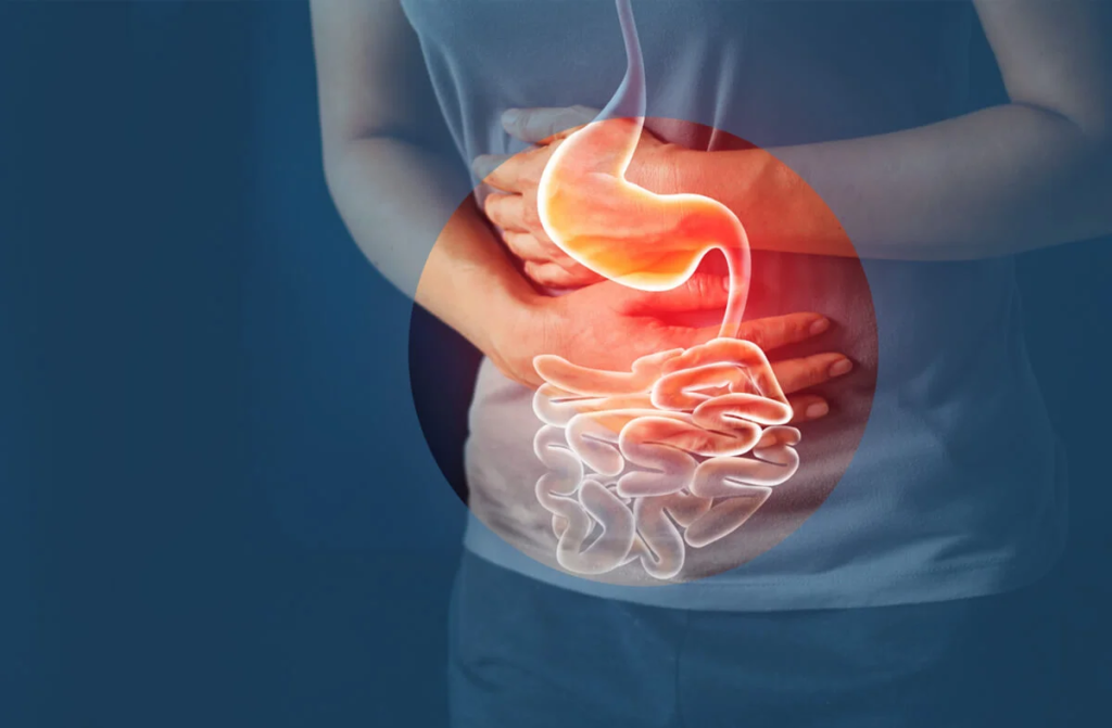 Crohn’s Disease (CD) Treatment Industry