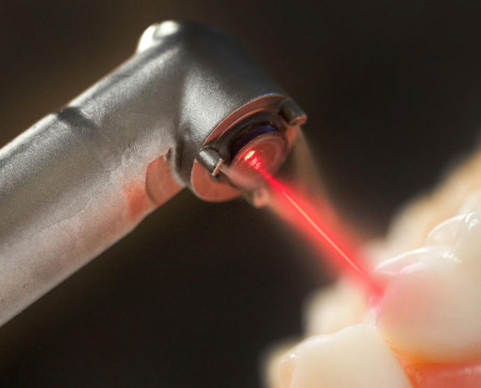 Dental Lasers Market