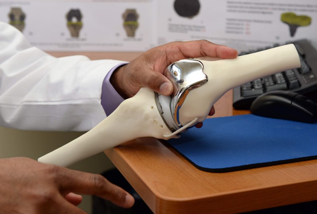 Endoprosthesis Industry