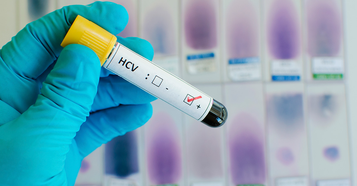 Global Hepatitis C Virus (HCV) Testing Industry