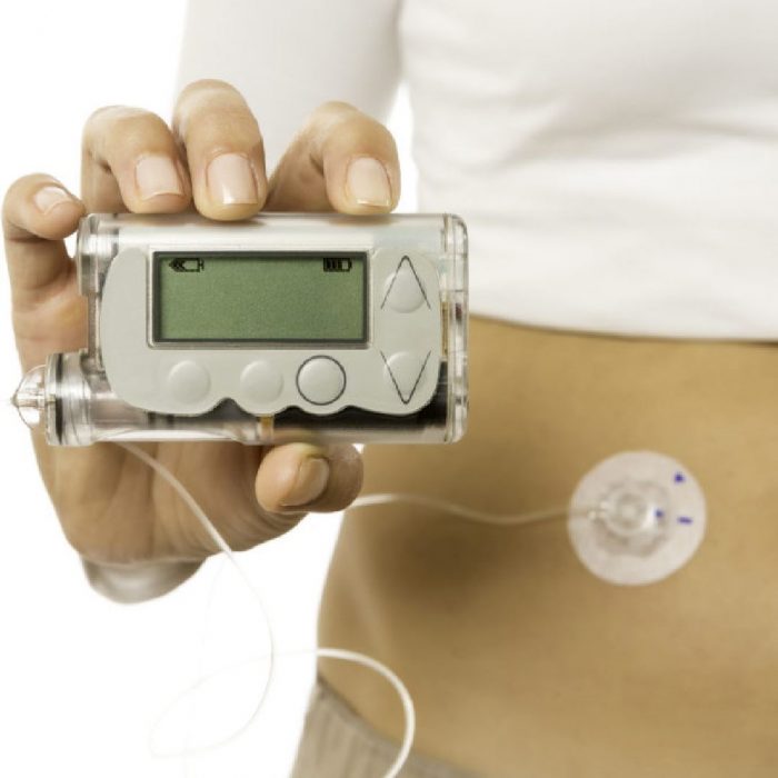 Global Insulin Pumps Industry