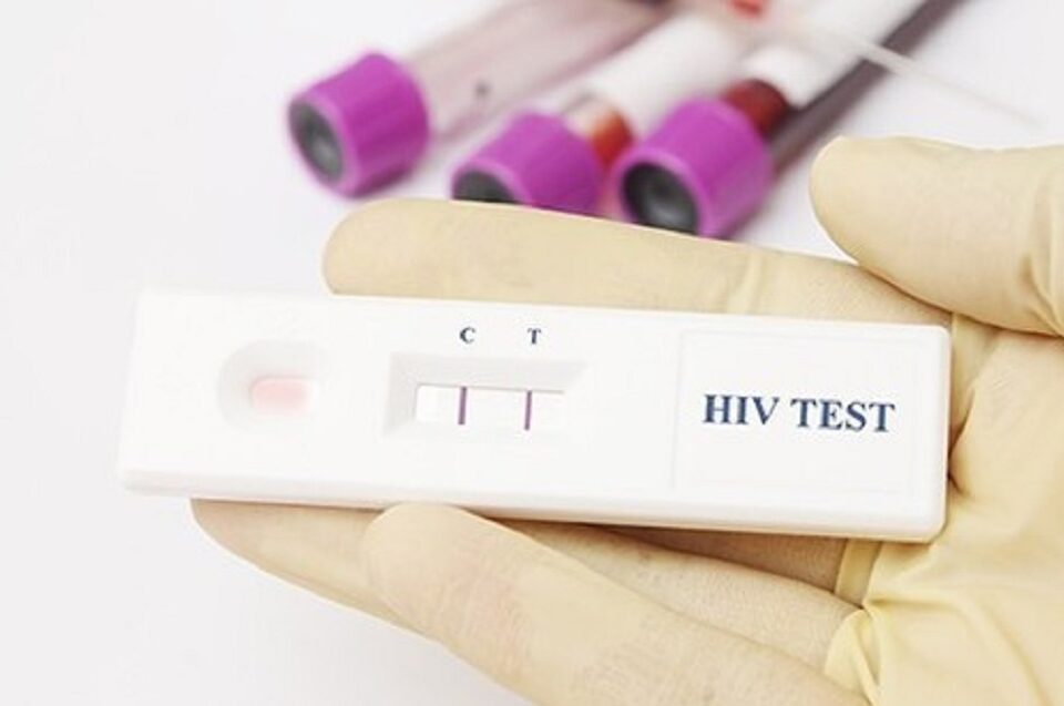 HIV Test Kits Market