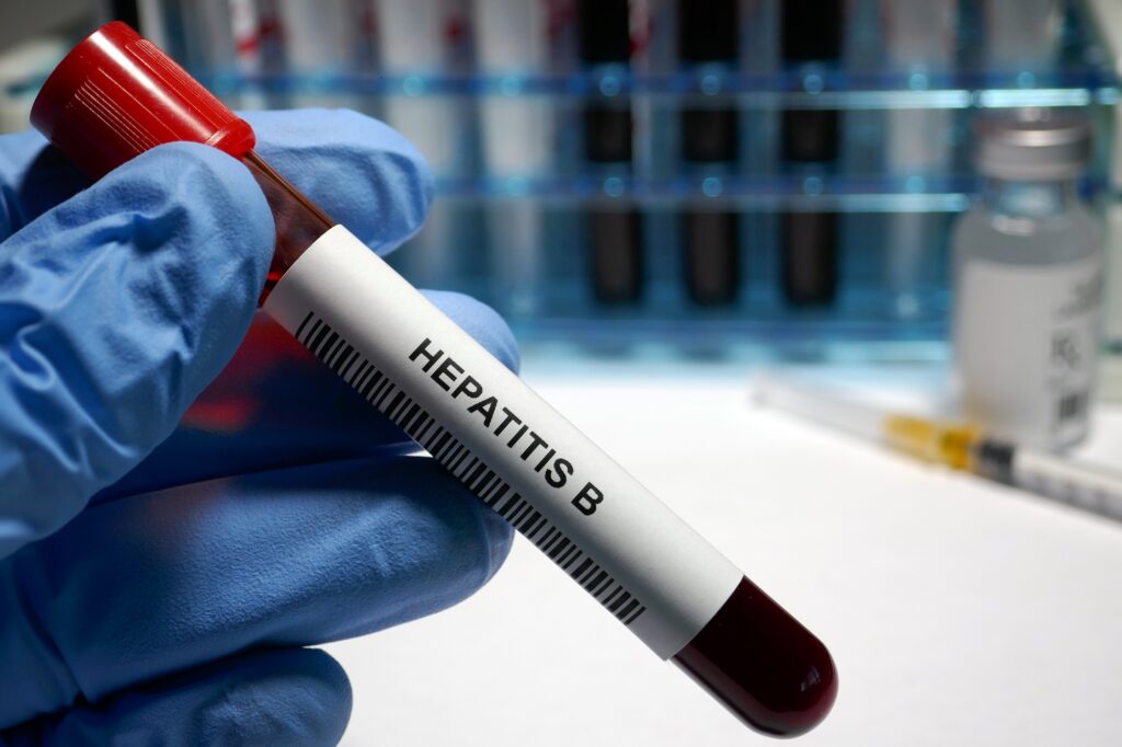 Hepatitis B Diagnostic Tests Industry