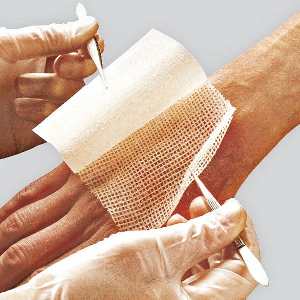 Interactive Wound Dressing Industry