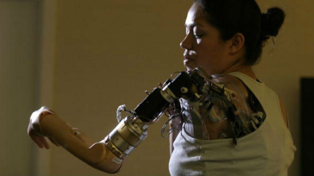 Medical Bionic Implants and Artificial Organs Industry