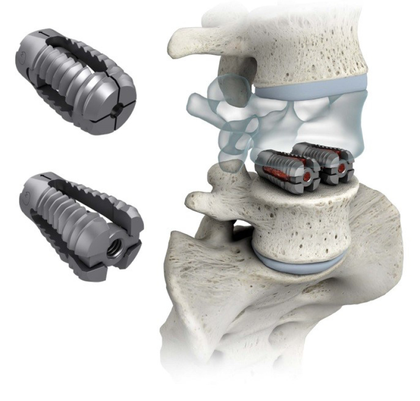 Global Non Fusion Spinal Devices Industry