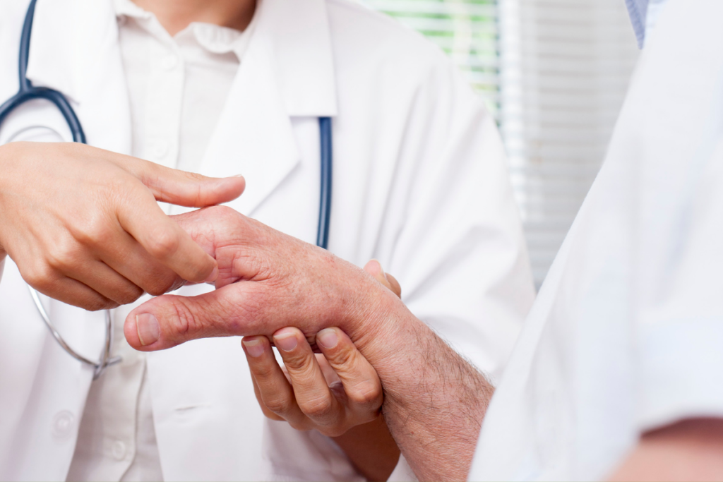 Psoriatic Arthritis (PsA) Treatment Industry