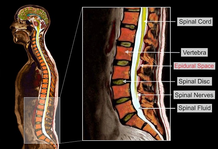 Spinal Imaging Industry