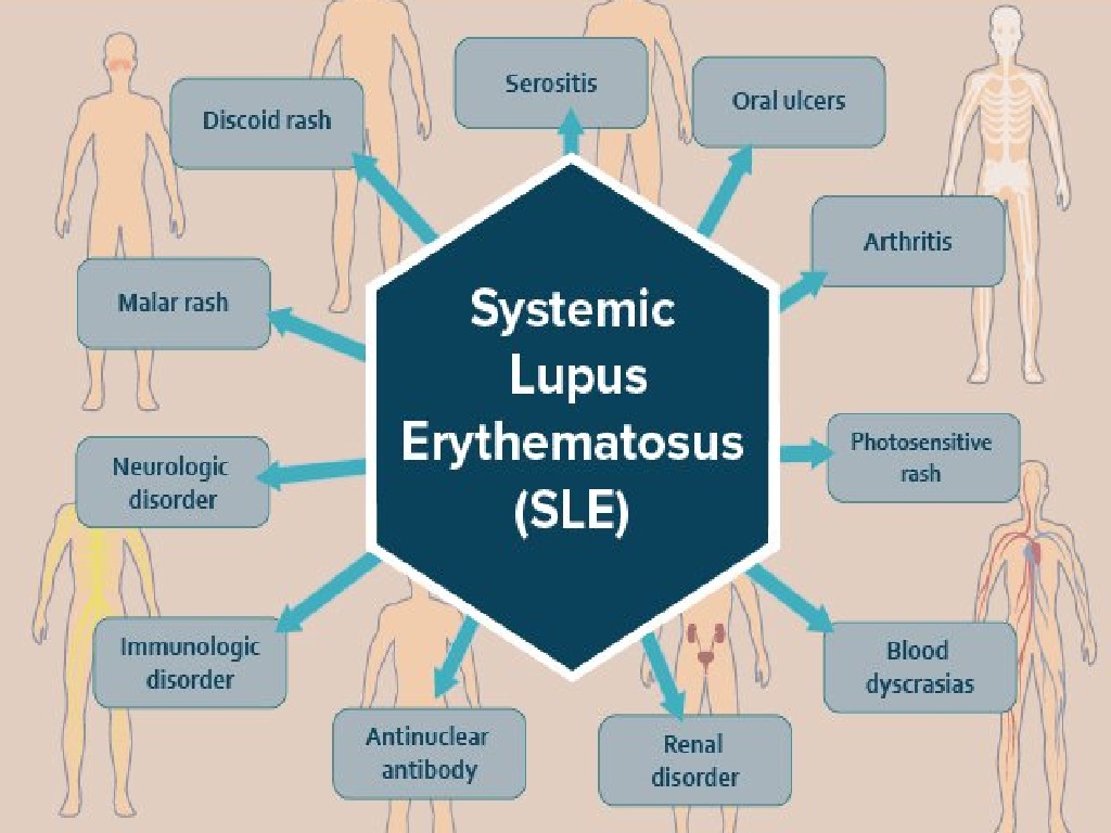 Systemic Lupus Erythematous Drugs Industry