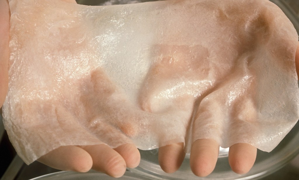 Tissue Engineered Skin Substitute Market