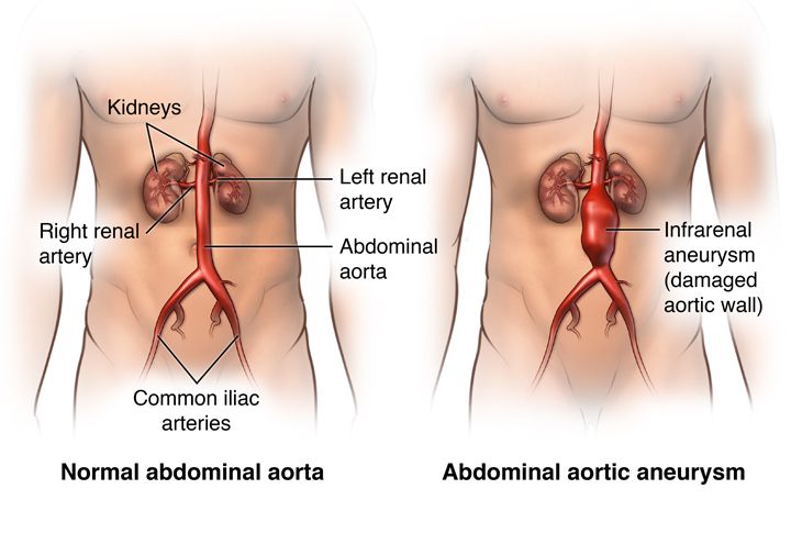 Abdominal Closure Systems Market