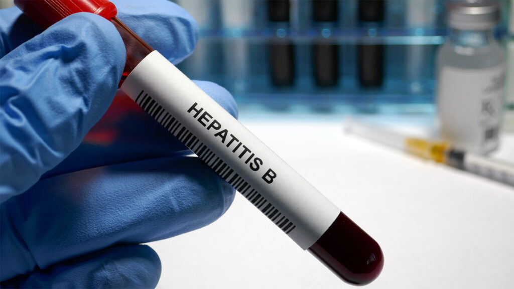 Chronic Hepatitis B Virus Testing Market