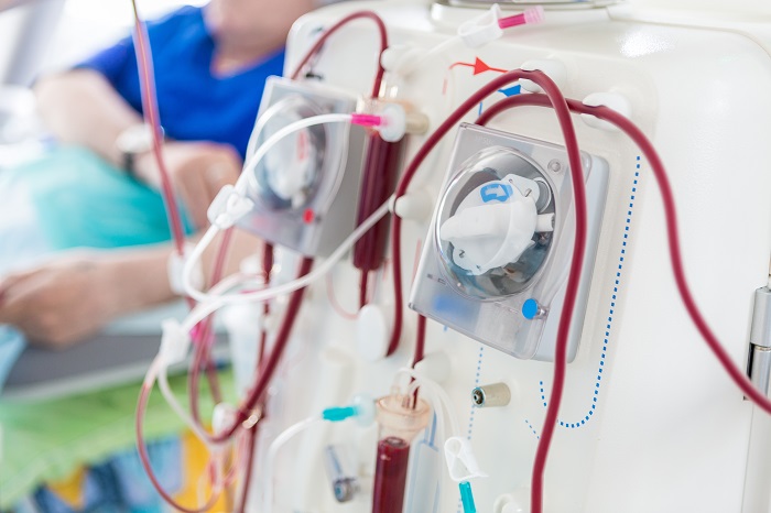 Dialysis Devices and Concentrates Market