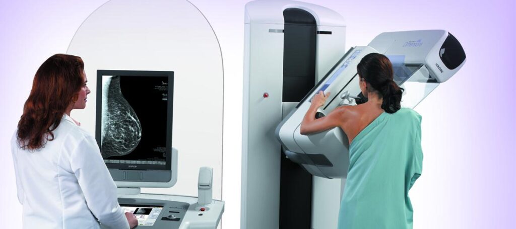 Global Digital Breast Tomosynthesis (DBT) Equipment Industry