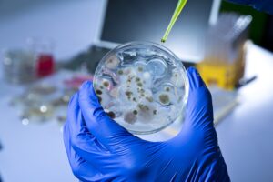 Microbial Fermentation Technology Market