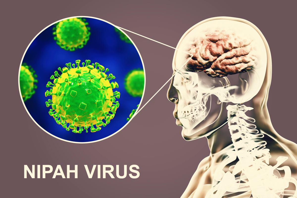 Global Nipah Virus (NiV) Infection Testing Industry