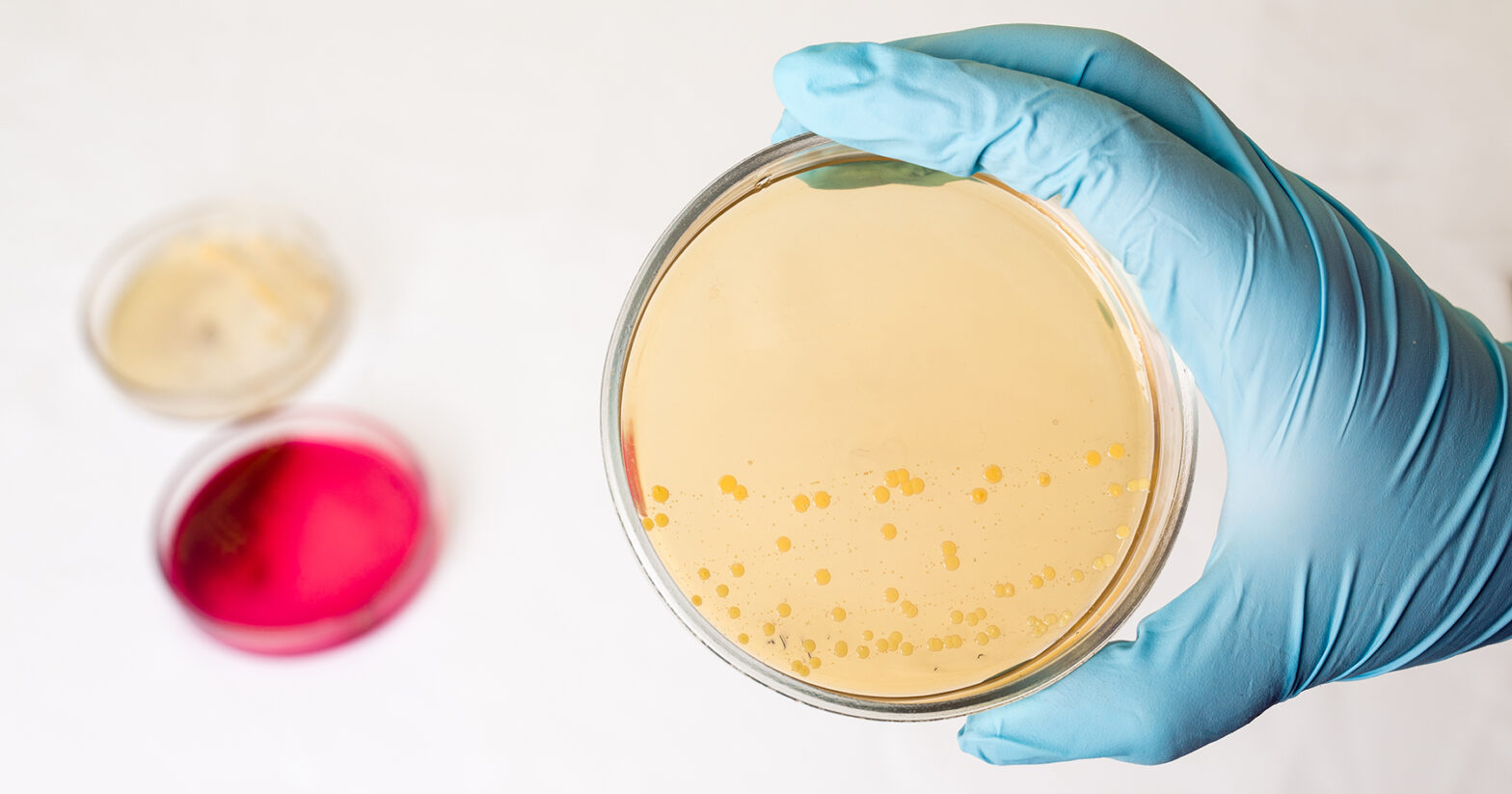 Global Staphylococcus Aureus Testing Industry