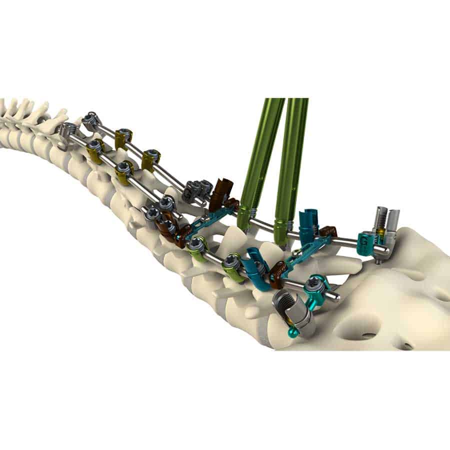 Global Thoracolumbar Stabilization Devices Industry