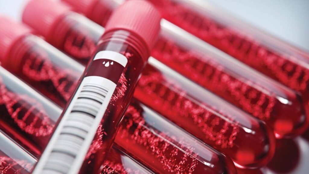 Liquid Biopsy Market