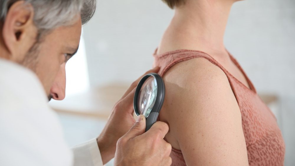 Skin Cancer Detection Devices Market