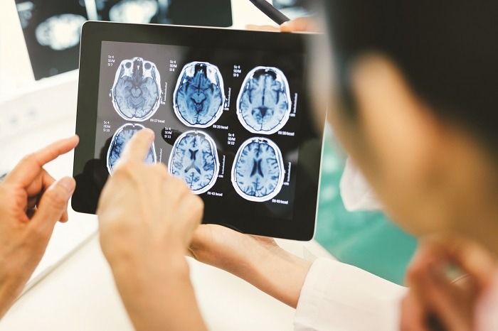 Brain Imaging and Neuroimaging Market