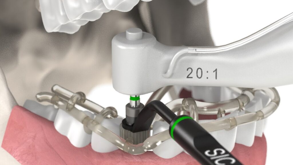 Dental Implantology Software Market