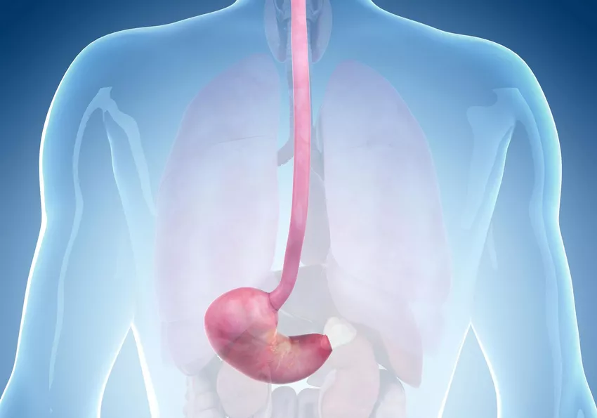 Eosinophilic Esophagitis Market