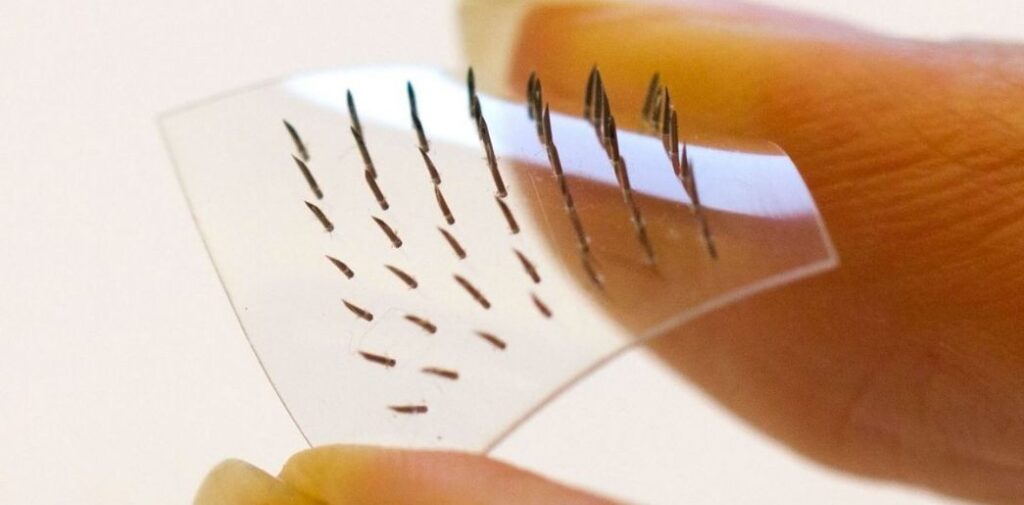 Global Dissolving Microneedles Market