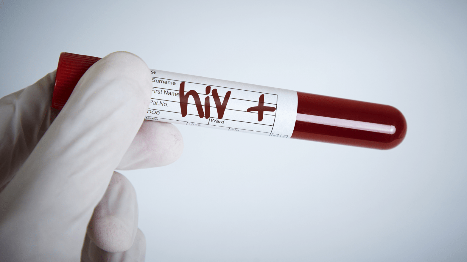 Global Human Immunodeficiency Virus Type 1 (HIV-1) Industry