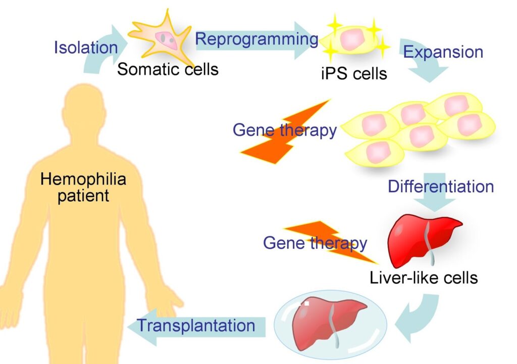 Hemophilia Treatment Market