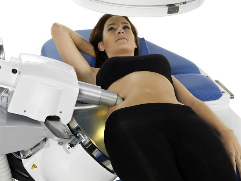 Lithotripsy Devices Market