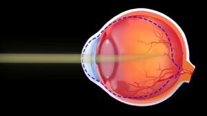 Myopia and Presbyopia Treatment Market