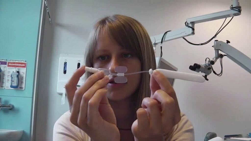 Nasal Packing Devices Market