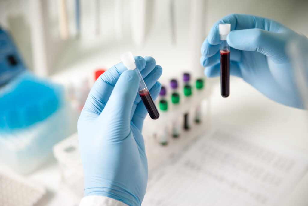 Oncology Blood Testing Market