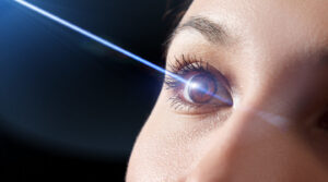 Ophthalmic Laser Industry