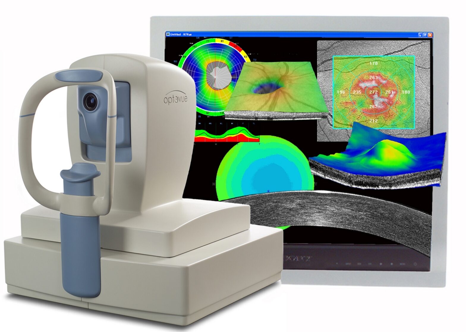 Global Optical Coherence Tomography Industry