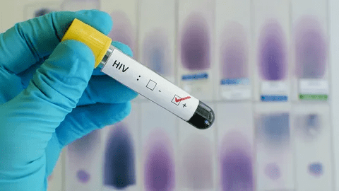 Global HIV/HBV/HCV Test Kits Market
