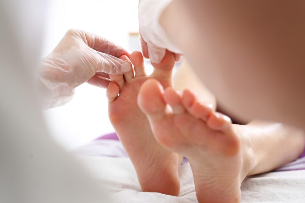 Tinea Pedis Treatment Market