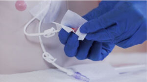 Vascular Access Catheters Industry 