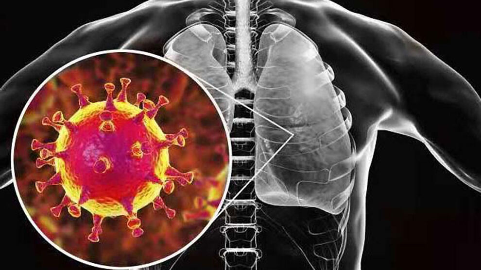 Community Acquired Bacterial Pneumonia (CABP) Treatment Market