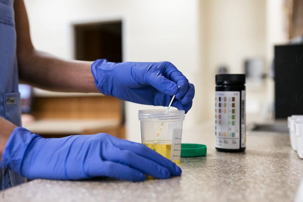 Genomic Urine Testing Market